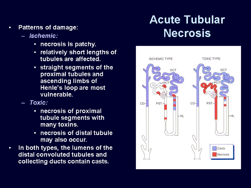 Acute Tubular Necrosis Patterns of damage: Ischemic: necrosis is patchy. relatively short lengths of